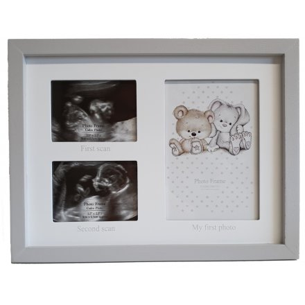 Bunny & Bear Scans Picture Frame 
